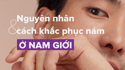 Bệnh nám da mặt ở nam giới: nguyên nhân và cách khắc phục
