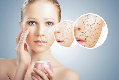 Cách chữa khô da vào mùa đông không lo nứt nẻ