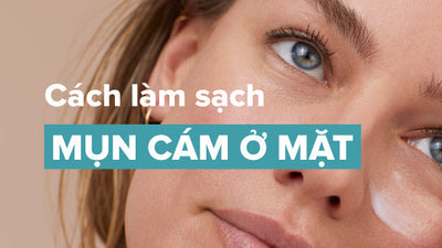 Chuyên gia chia sẻ cách làm sạch mụn cám ở mặt hiệu quả