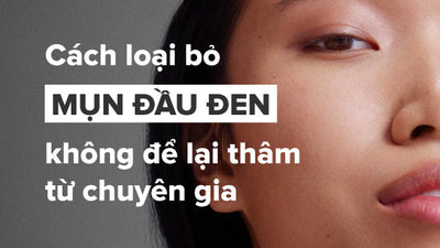 Mụn đầu đen là gì? Nguyên nhân và cách loại bỏ mụn đầu đen hiệu quả