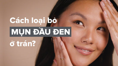 Cách ngăn ngừa và loại bỏ mụn đầu đen ở trán an toàn và hiệu quả
