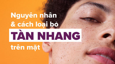 Nguyên nhân và cách loại bỏ tàn nhang trên mặt hiệu quả