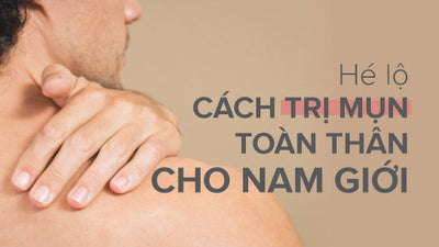 Hướng dẫn cách trị mụn toàn thân cho nam giới