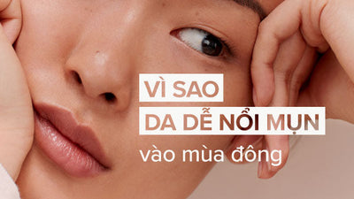 Vì sao da bị nổi mụn vào mùa đông? Cách khắc phục hiệu quả