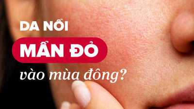 Nguyên nhân và cách khắc phục da nổi mẩn đỏ vào mùa đông
