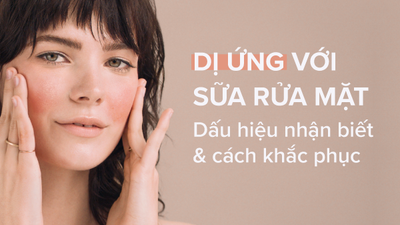 Dị ứng sữa rửa mặt - Dấu hiệu nhận biết và cách khắc phục