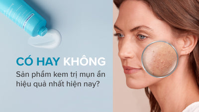Có hay không sản phẩm kem trị mụn ẩn hiệu quả nhất hiện nay?