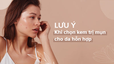 Những lưu ý khi chọn kem trị mụn cho da hỗn hợp