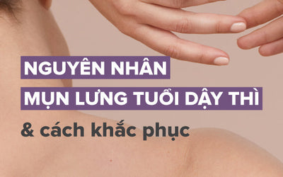 Nguyên nhân mụn lưng tuổi dậy thì và cách khắc phục từ chuyên gia