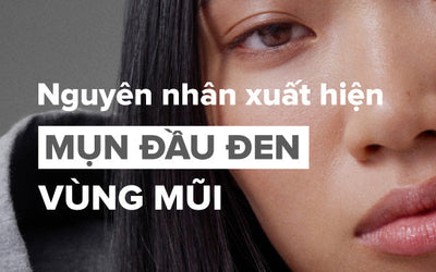 Nguyên nhân nổi mụn đầu đen ở mũi và cách khắc phục hiệu quả