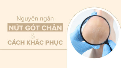 Nguyên nhân nứt gót chân và cách khắc phục từ chuyên gia