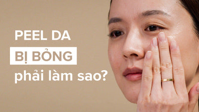 Peel da bị bỏng phải làm sao? Chuyên gia chia sẻ nguyên nhân và cách xử lý