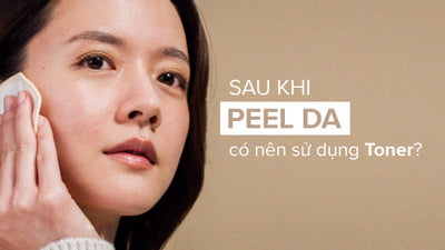 Chuyên gia giải đáp: Sau khi peel da xong có nên dùng toner không?