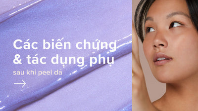 Tổng hợp các biến chứng và tác dụng phụ sau khi peel da