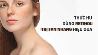 Thực hư dùng Retinol trị tàn nhang hiệu quả rõ rệt