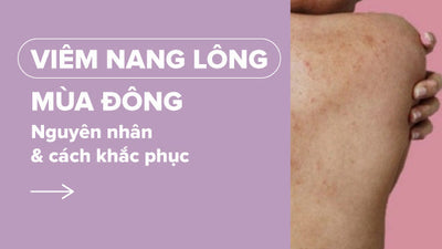 Nguyên nhân viêm nang lông mùa đông và cách khắc phục chuẩn chuyên gia