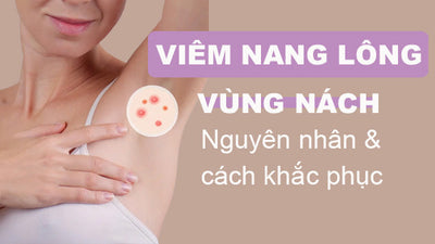 Nguyên nhân viêm nang lông ở nách và cách khắc phục từ chuyên gia