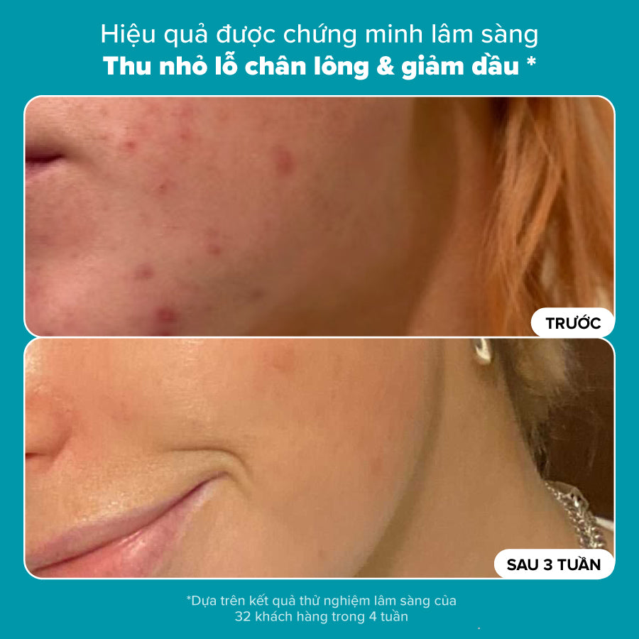 Dung dịch loại bỏ tế bào chết Skin Perfecting 2% BHA Liquid Exfoliant