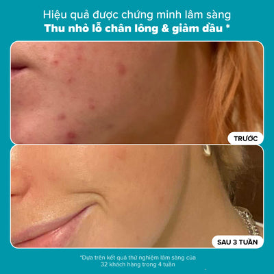 Dung dịch loại bỏ tế bào chết Skin Perfecting 2% BHA Liquid Exfoliant