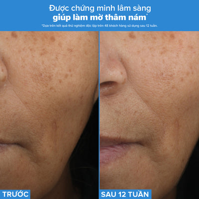 Tinh chất 3 tác động chống lão hóa,  mờ thâm nám, giảm nếp nhăn và săn chắc da Resist Triple Active Total Repair Serum 30ml