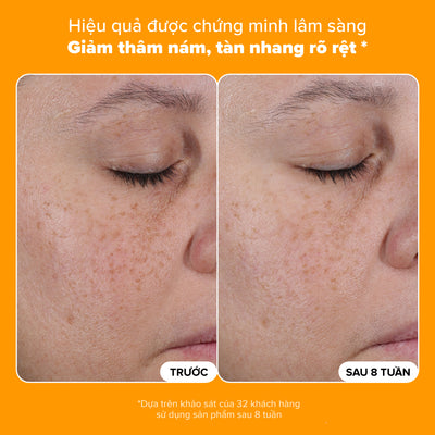 Tinh chất làm sáng da và mờ nám chuyên sâu với 25% Vitamin C 25% Vitamin C + Glutathione Clinical Serum 30ml