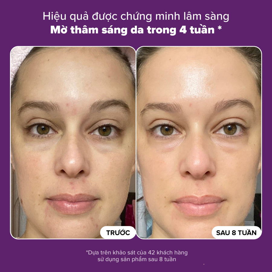 Tinh chất làm mờ thâm nám và làm sáng da Clinical Discoloration Repair Serum 30ml