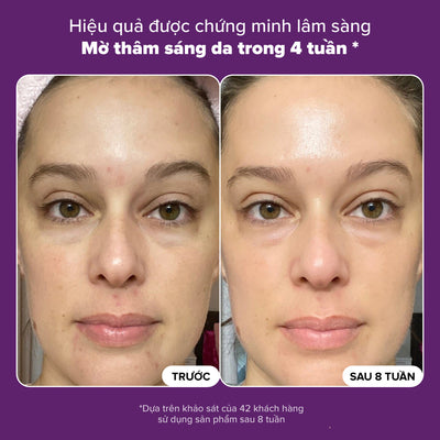Tinh chất làm mờ thâm nám và làm sáng da Clinical Discoloration Repair Serum 30ml