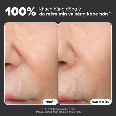 Dung dịch loại bỏ tế bào chết và làm sáng da Skin Perfecting 6% Mandelic Acid + 2% Lactic Acid Liquid Exfoliant