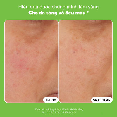 Tinh chất giúp thu nhỏ lỗ chân lông và làm sáng da 10% Niacinamide Booster 20ml