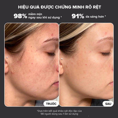 Tinh chất thay da sinh học giúp da sáng mịn Skin Perfecting 25% AHA + 2% BHA Exfoliant Peel 30ml