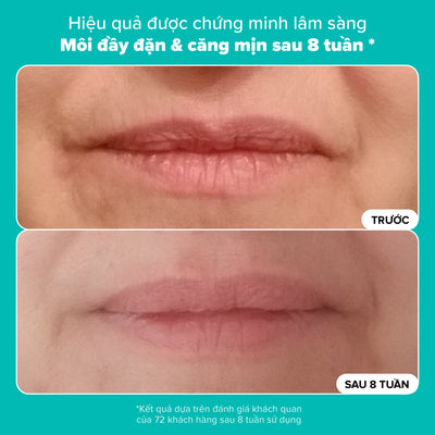 Tinh chất dưỡng môi căng bóng Hyaluronic Acid + Peptide Lip Booster 10ml