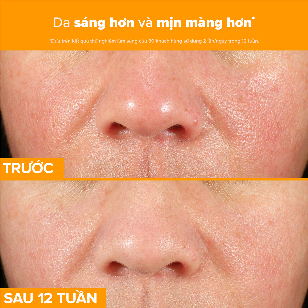 Tinh chất làm sáng da, mờ thâm nám và giảm nếp nhăn chứa 15% Vitamin C C15 Super Booster 20ml