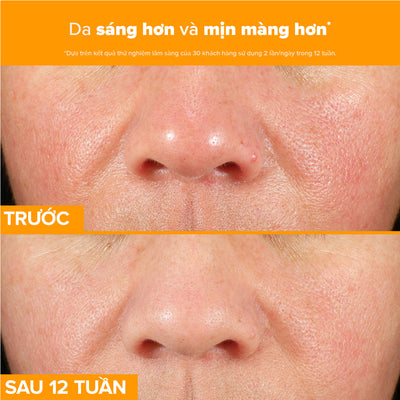 Tinh chất làm sáng da, mờ thâm nám và giảm nếp nhăn chứa 15% Vitamin C C15 Super Booster 20ml