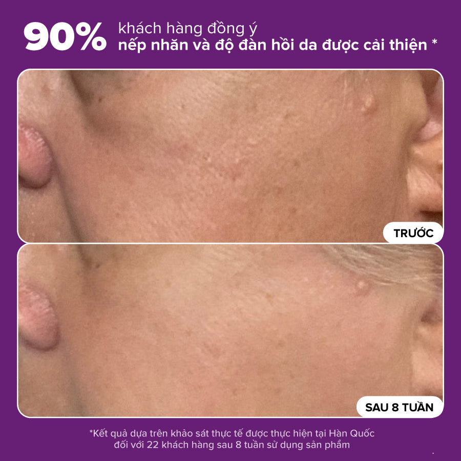 Tinh chất thu nhỏ lỗ chân lông to và làm sáng mịn bề mặt da Clinical Niacinamide 20% Treatment 20ml