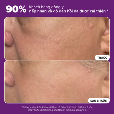 Tinh chất thu nhỏ lỗ chân lông to và làm sáng mịn bề mặt da Clinical Niacinamide 20% Treatment 20ml