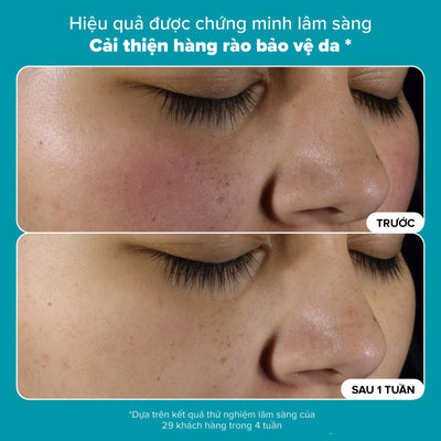 Dung dịch loại bỏ tế bào chết Skin Perfecting 2% BHA Liquid Exfoliant