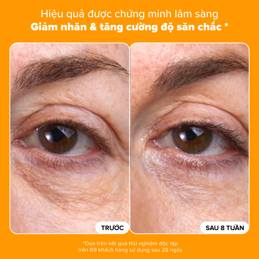 Kem mắt làm mờ quầng thâm, bọng mắt và giảm nếp nhăn với 5% Vitamin C C5 Super Boost Eye Cream