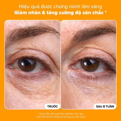 Kem mắt làm mờ quầng thâm, bọng mắt và giảm nếp nhăn với 5% Vitamin C C5 Super Boost Eye Cream