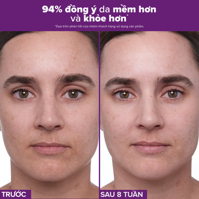 Tinh chất làm mờ nám và nếp nhăn Clinical 1% Retinol Treatment