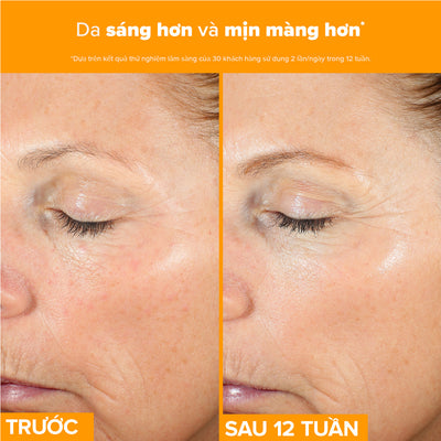 Tinh chất làm sáng da, mờ thâm nám và giảm nếp nhăn chứa 15% Vitamin C C15 Super Booster 20ml