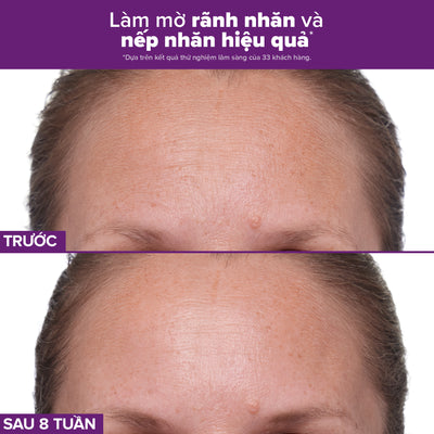 Tinh chất làm mờ nám và nếp nhăn Clinical 1% Retinol Treatment