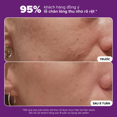 Tinh chất thu nhỏ lỗ chân lông to và làm sáng mịn bề mặt da Clinical Niacinamide 20% Treatment 20ml