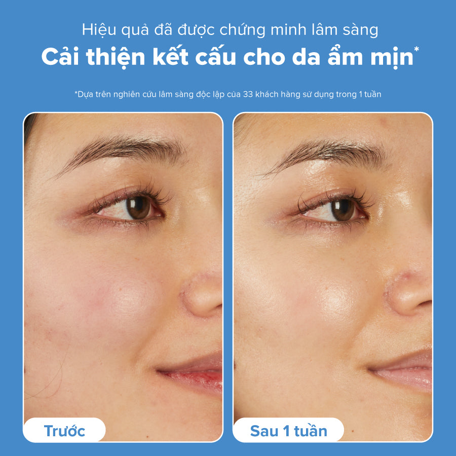 Tinh chất phục hồi & bảo vệ da 7 tác động 7% Ectoin Booster
