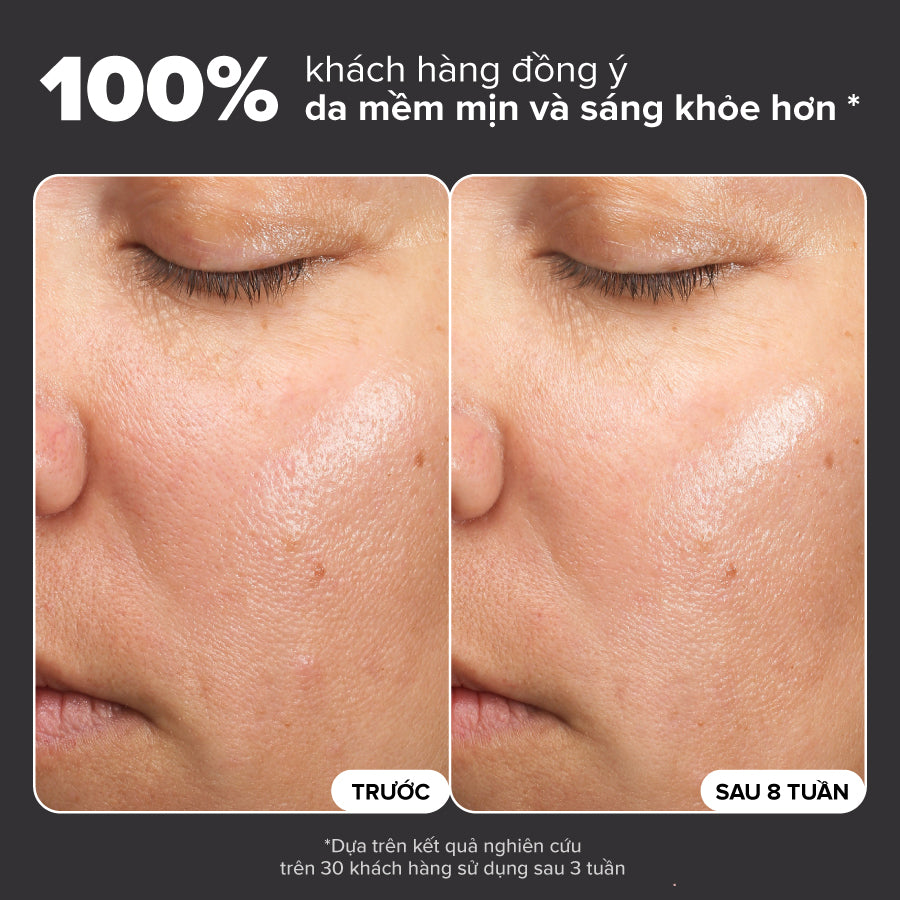 Dung dịch loại bỏ tế bào chết và làm sáng da Skin Perfecting 6% Mandelic Acid + 2% Lactic Acid Liquid Exfoliant