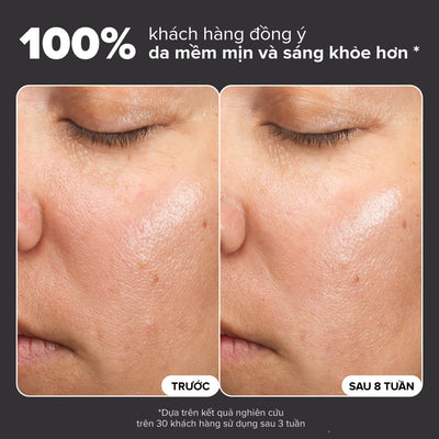 Dung dịch loại bỏ tế bào chết và làm sáng da Skin Perfecting 6% Mandelic Acid + 2% Lactic Acid Liquid Exfoliant