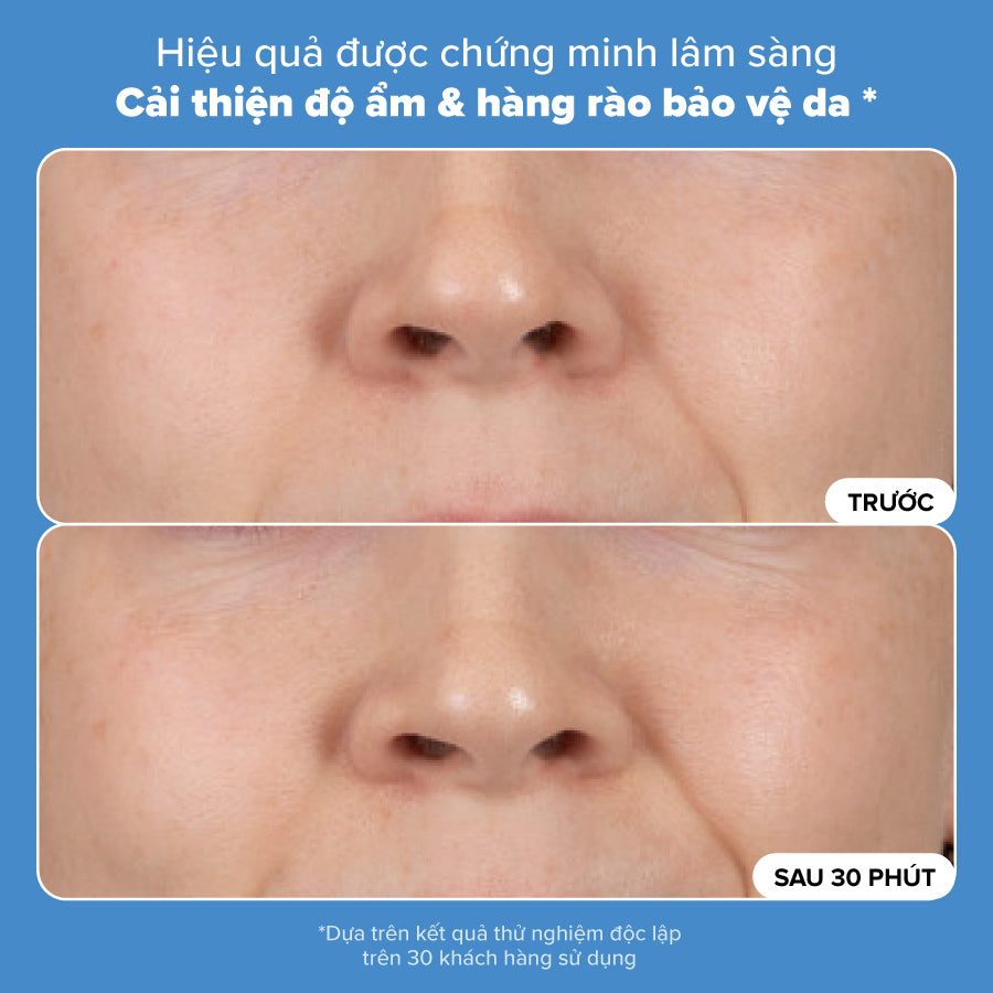Kem dưỡng ẩm tái tạo hàng rào bảo vệ da, giảm nếp nhăn và làm săn chắc da Resist Barrier Repair Advanced Moisturizer 50ml