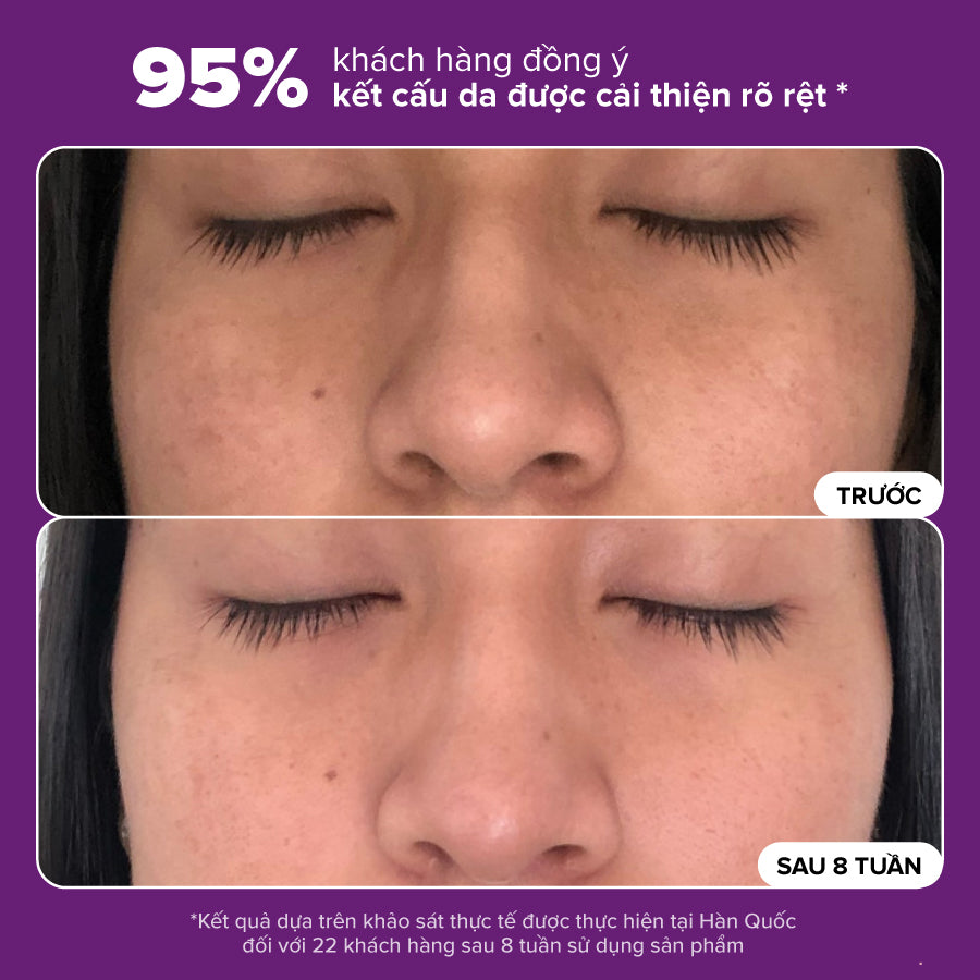 Tinh chất thu nhỏ lỗ chân lông to và làm sáng mịn bề mặt da Clinical Niacinamide 20% Treatment 20ml