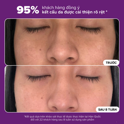Tinh chất thu nhỏ lỗ chân lông to và làm sáng mịn bề mặt da Clinical Niacinamide 20% Treatment 20ml