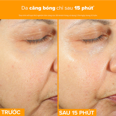Tinh chất làm sáng da, mờ thâm nám và giảm nếp nhăn chứa 15% Vitamin C C15 Super Booster 20ml