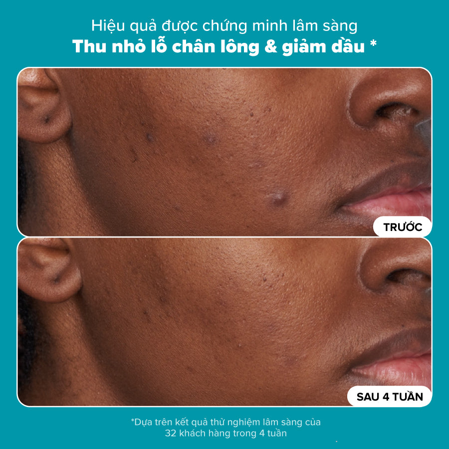 Dung dịch loại bỏ tế bào chết Skin Perfecting 2% BHA Liquid Exfoliant